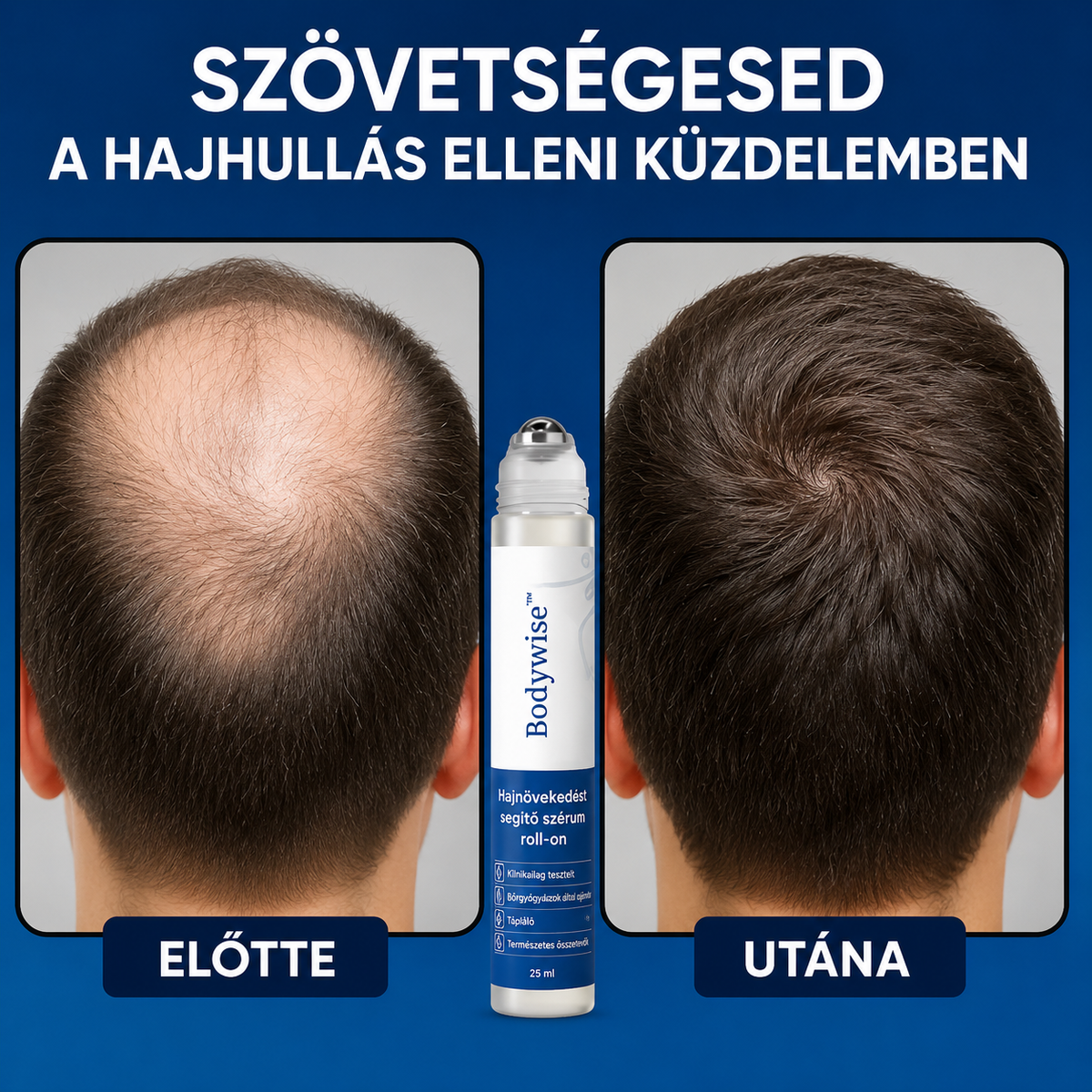 Capilux - sűrűbb, erősebb haj